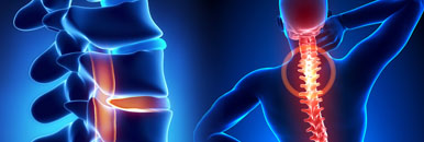 Neuro & Spinal Surgery